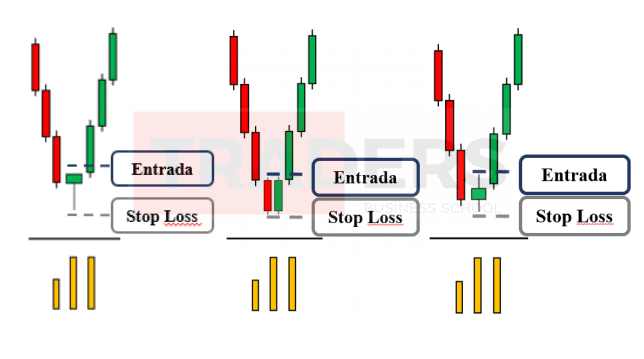 Stop loss